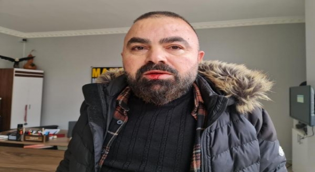 Tekirdağ’da gazeteciye yumruklu saldırı